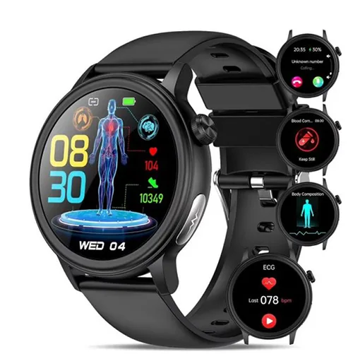 Smartwatch